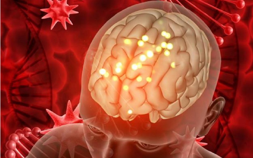 La encefalitis: Causas, síntomas y prevención
